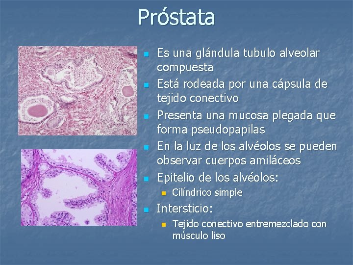 epitelio de la próstata