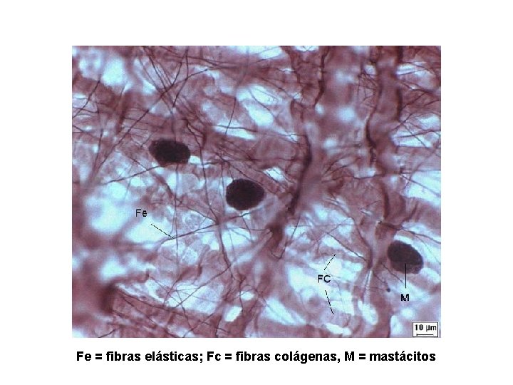 Fe = fibras elásticas; Fc = fibras colágenas, M = mastácitos 