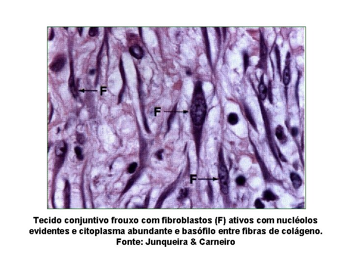 Tecido conjuntivo frouxo com fibroblastos (F) ativos com nucléolos evidentes e citoplasma abundante e