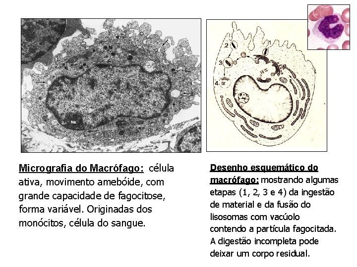 Micrografia do Macrófago: célula ativa, movimento amebóide, com grande capacidade de fagocitose, forma variável.