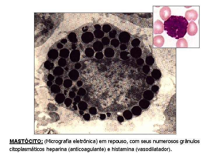 MASTÓCITO: (Micrografia eletrônica) em repouso, com seus numerosos grânulos citoplasmáticos heparina (anticoagulante) e histamina