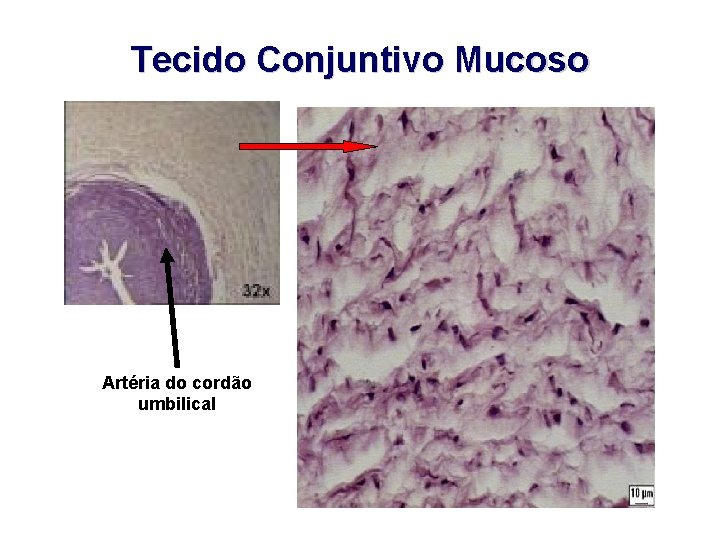 Tecido Conjuntivo Mucoso Artéria do cordão umbilical 