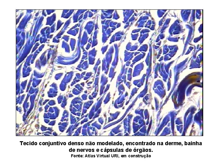 Tecido conjuntivo denso não modelado, encontrado na derme, bainha de nervos e cápsulas de