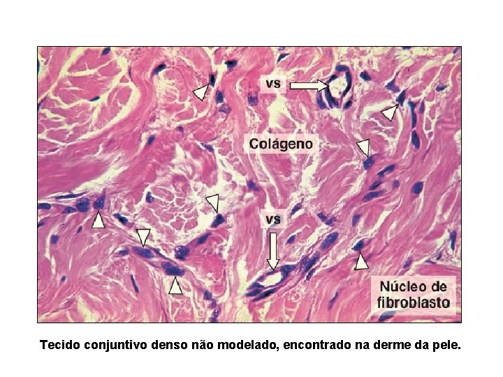 Tecido conjuntivo denso não modelado, encontrado na derme da pele. 