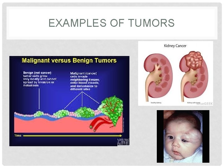 CANCER AND MITOSIS CASE STUDY BIOLOGY OBJECTIVES SC