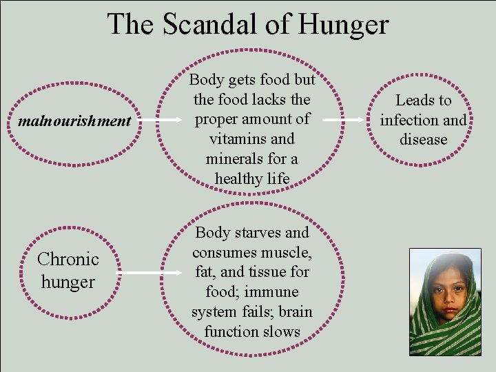 The Scandal of Hunger malnourishment Chronic hunger Body gets food but the food lacks The Scandal of Hunger malnourishment Chronic hunger Body gets food but the food lacks