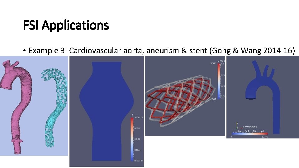 FSI Applications • Example 3: Cardiovascular aorta, aneurism & stent (Gong & Wang 2014