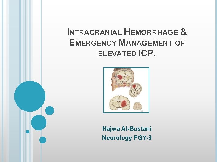 INTRACRANIAL HEMORRHAGE & EMERGENCY MANAGEMENT OF ELEVATED ICP. Najwa Al-Bustani Neurology PGY-3 