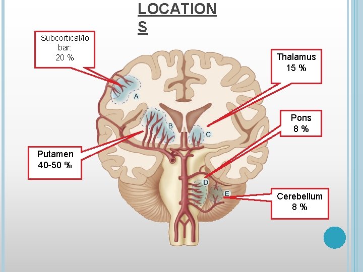 Subcortical/lo bar: 20 % LOCATION S Thalamus 15 % Pons 8% Putamen 40 -50