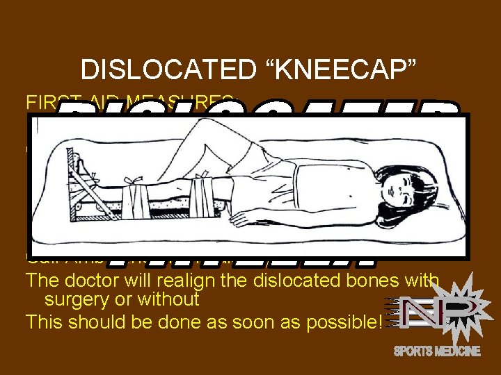 DISLOCATED “KNEECAP” FIRST AID MEASURES: Keep person warm to decrease shock possibility Cut away