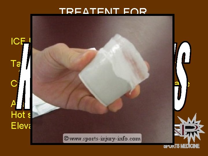TREATENT FOR KNEE BURSITIS ICE MASSAGE: Take a styrofoam cup, fill it with water