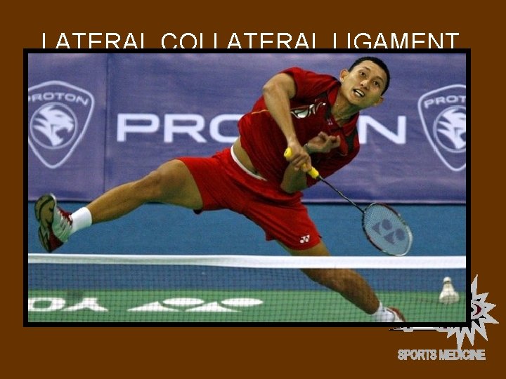 LATERAL COLLATERAL LIGAMENT INJURY Lateral Collateral Ligament (LCL) Occurs when opponent is blocked or