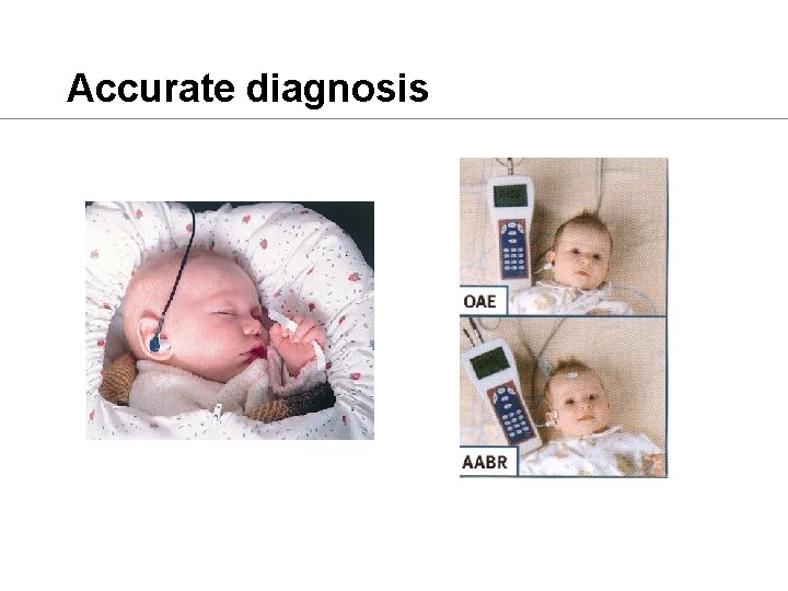 Accurate diagnosis 