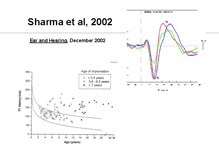 Sharma et al, 2002 Ear and Hearing, December 2002 
