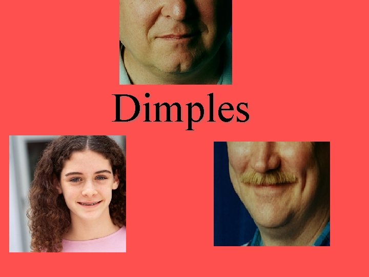 Dimples 