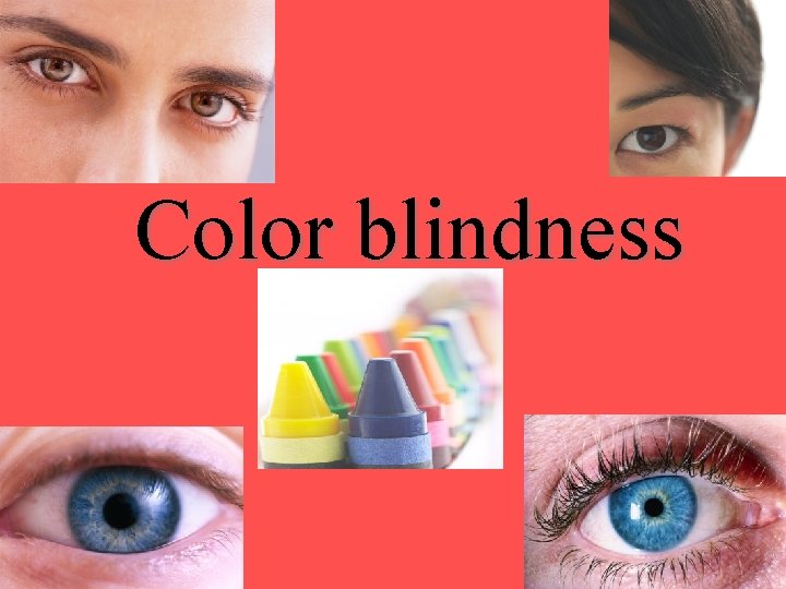 Color blindness 