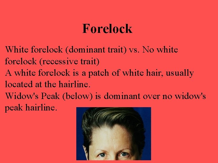 Forelock White forelock (dominant trait) vs. No white forelock (recessive trait) A white forelock