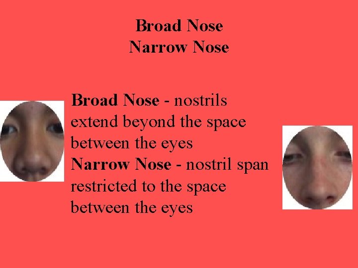 Broad Nose Narrow Nose Broad Nose - nostrils extend beyond the space between the