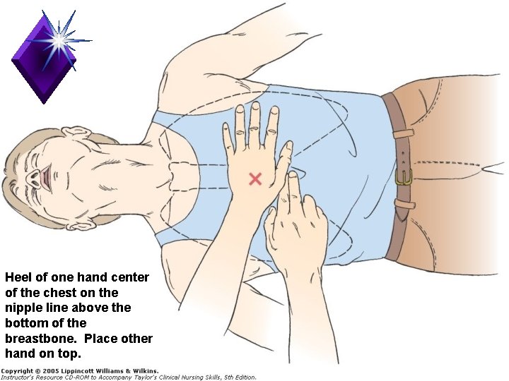 Heel of one hand center of the chest on the nipple line above the