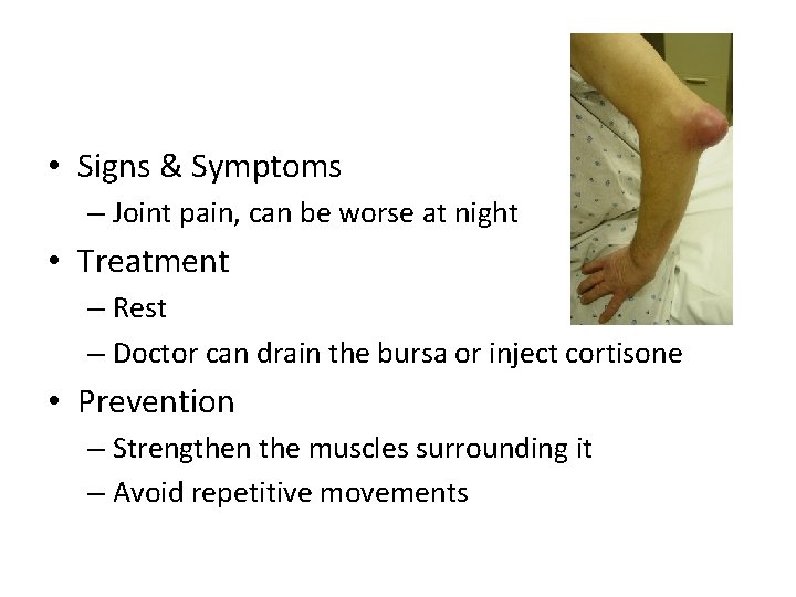  • Signs & Symptoms – Joint pain, can be worse at night •