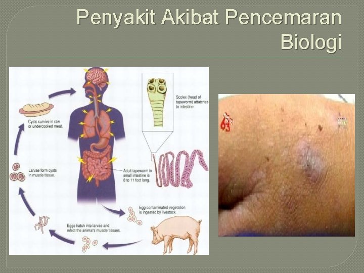 Penyakit Akibat Pencemaran Biologi 