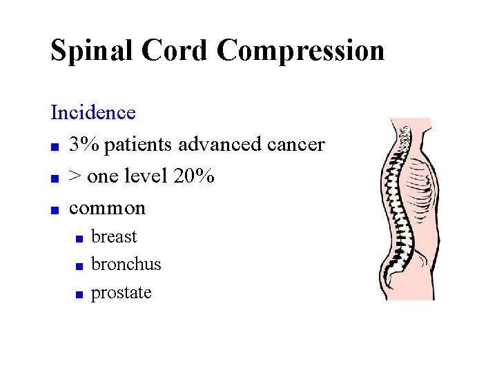 Spinal Cord Compression Incidence ■ 3% patients advanced cancer ■ > one level 20%