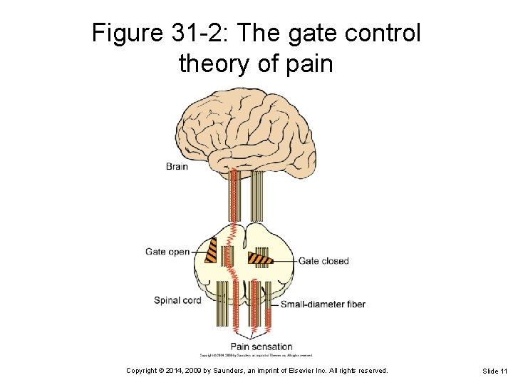 Figure 31 -2: The gate control theory of pain Copyright © 2014, 2009 by