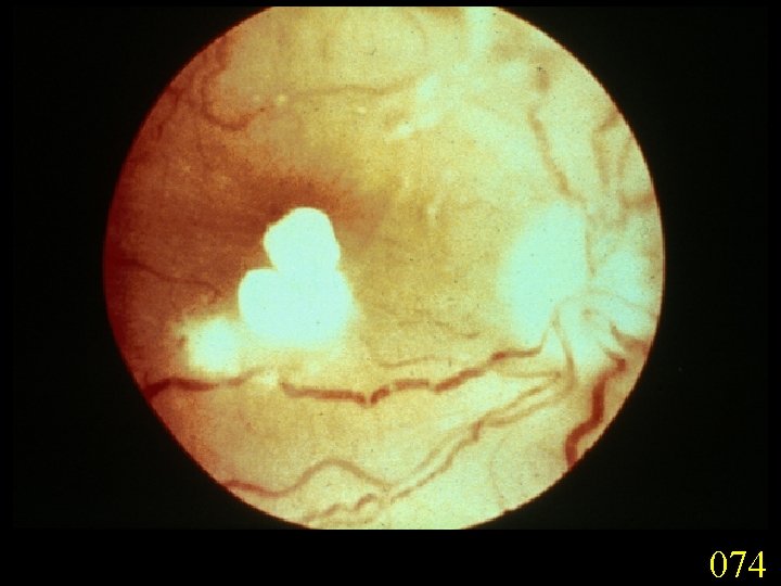 074 