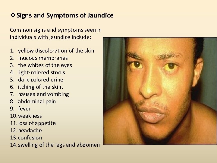 v. Signs and Symptoms of Jaundice Common signs and symptoms seen in individuals with v. Signs and Symptoms of Jaundice Common signs and symptoms seen in individuals with