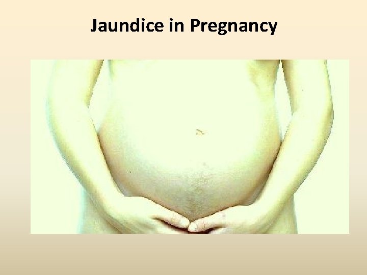 Jaundice in Pregnancy Jaundice in Pregnancy