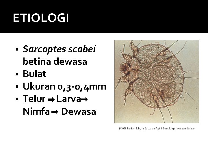 ETIOLOGI Sarcoptes scabei betina dewasa § Bulat § Ukuran 0, 3 -0, 4 mm