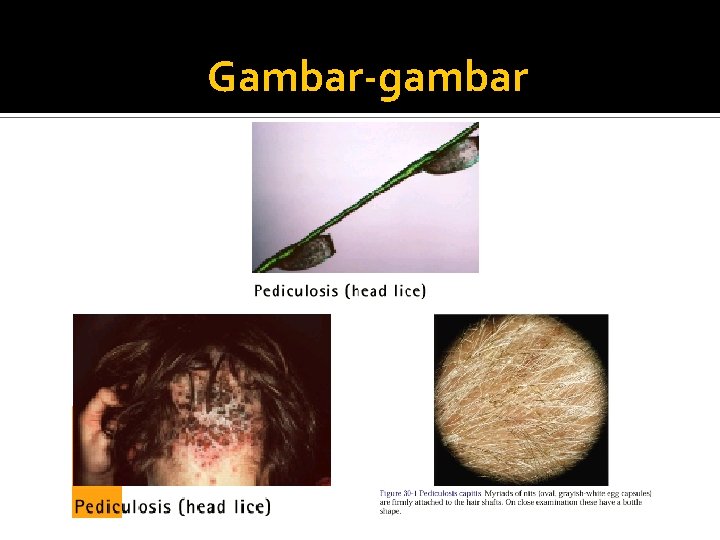 Gambar-gambar 