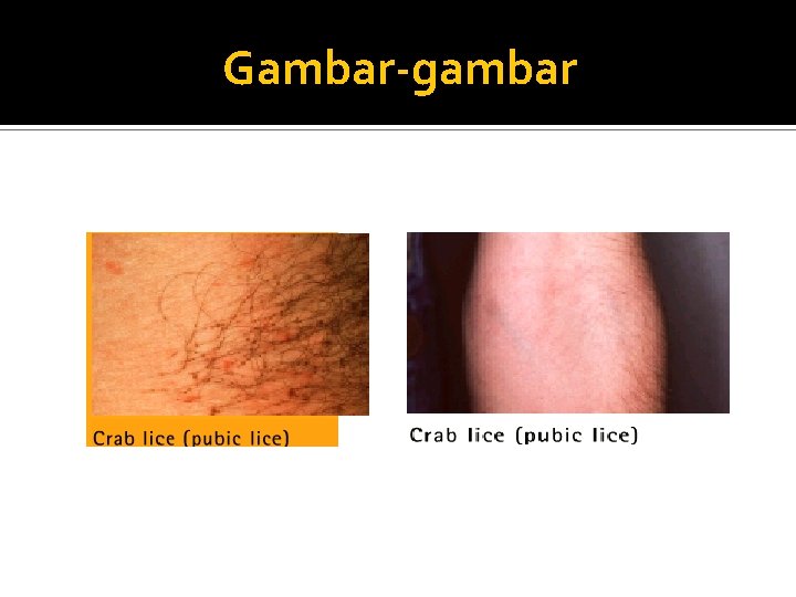 Gambar-gambar 