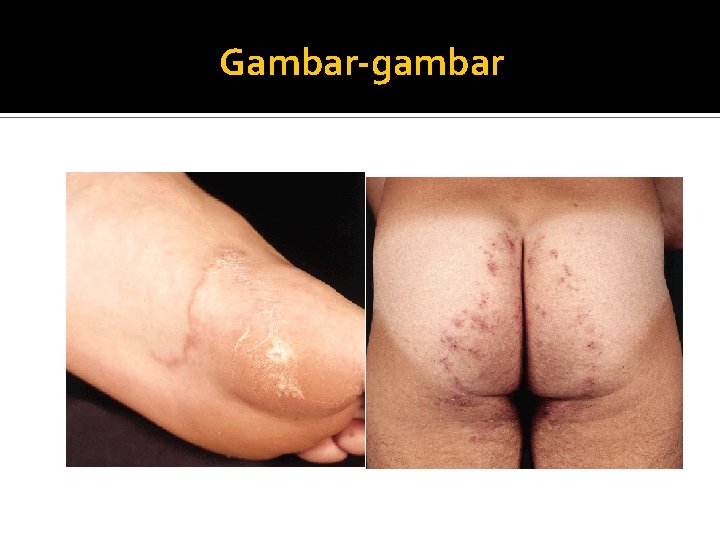 Gambar-gambar 