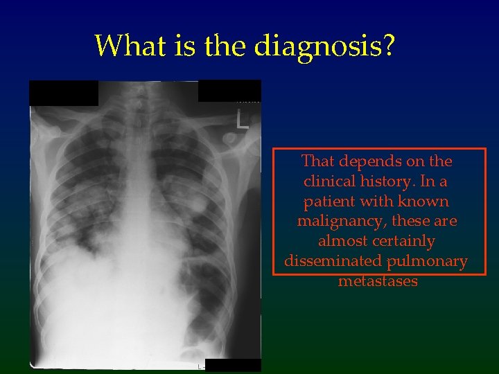 What is the diagnosis? That depends on the clinical history. In a patient with