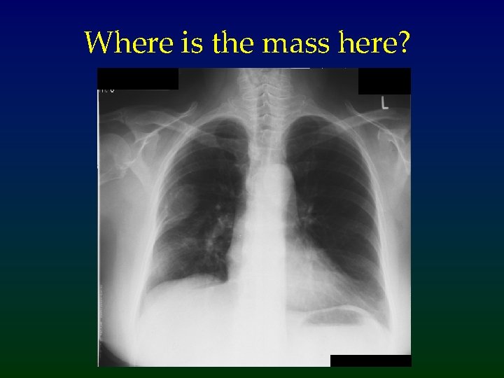 Where is the mass here? 