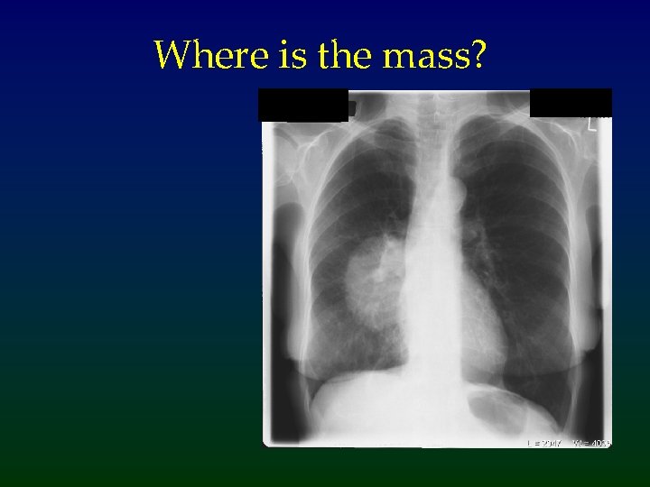 Where is the mass? 