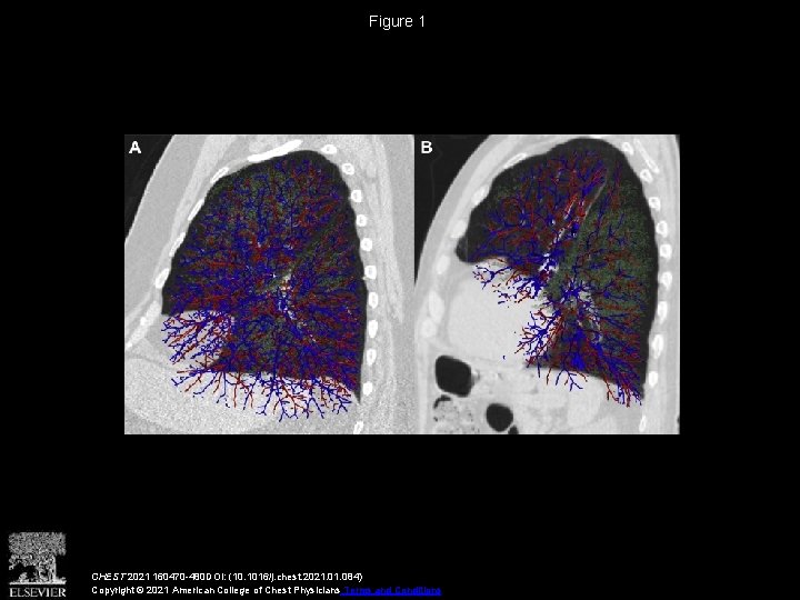 Figure 1 CHEST 2021 160470 -480 DOI: (10. 1016/j. chest. 2021. 084) Copyright ©