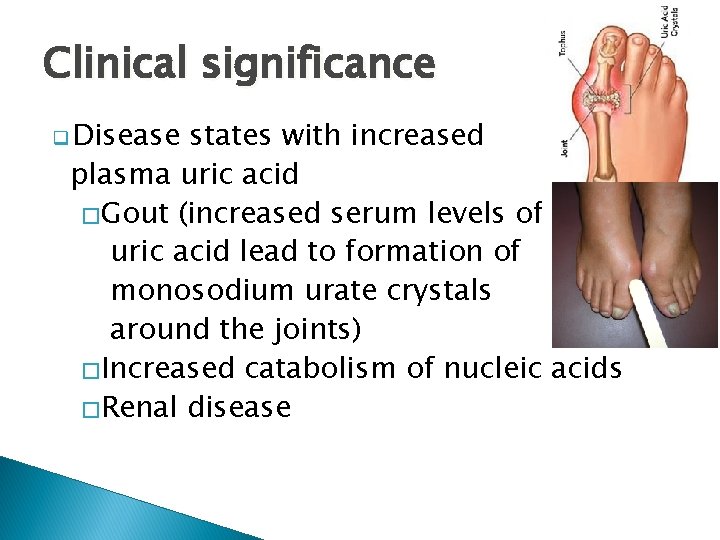 Clinical significance q Disease states with increased plasma uric acid �Gout (increased serum levels