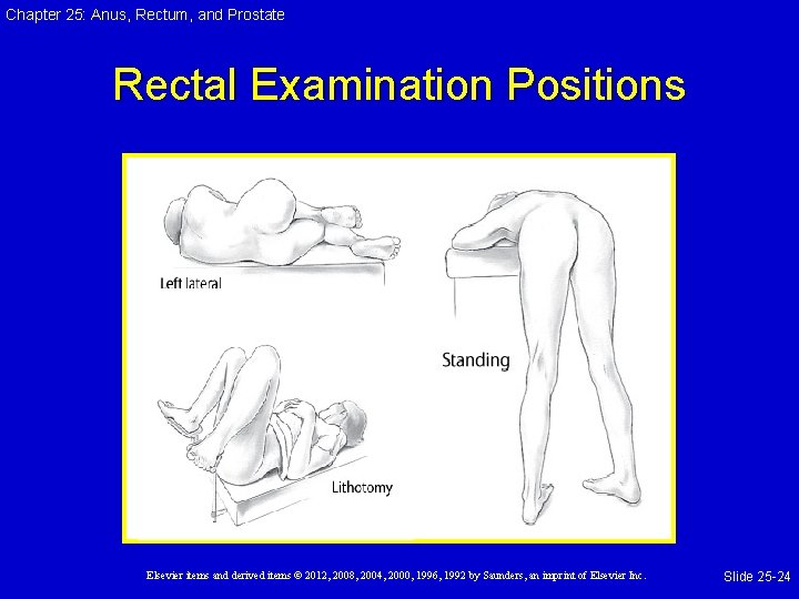 Chapter 25: Anus, Rectum, and Prostate Rectal Examination Positions Elsevier items and derived items Chapter 25: Anus, Rectum, and Prostate Rectal Examination Positions Elsevier items and derived items