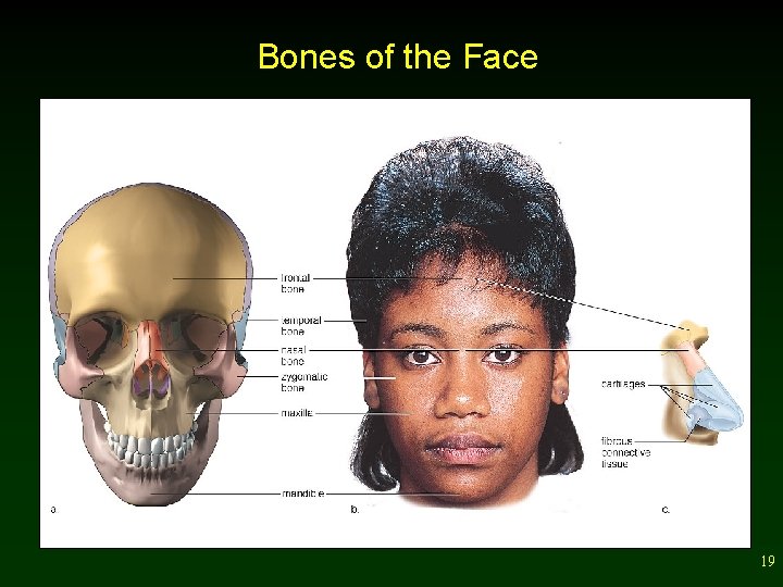 Bones of the Face 19 