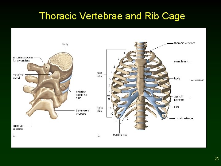 Thoracic Vertebrae and Rib Cage 25 