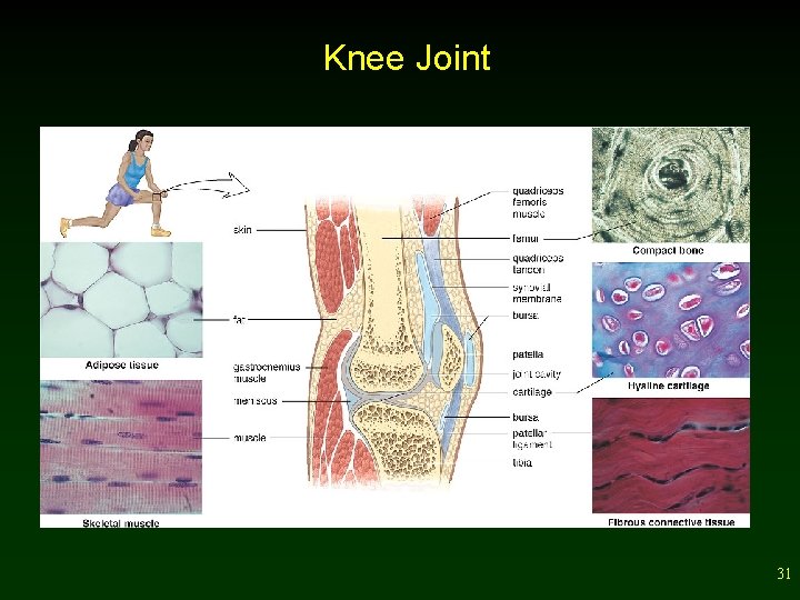 Knee Joint 31 