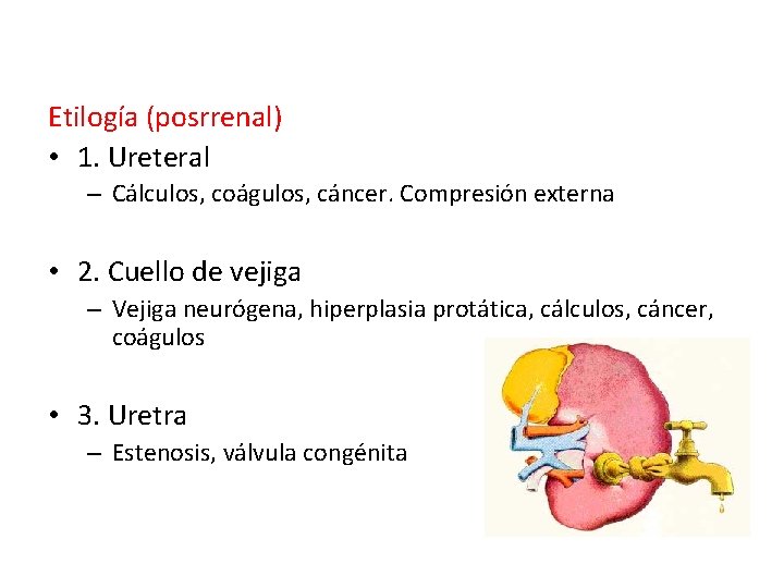 Etilogía (posrrenal) • 1. Ureteral – Cálculos, coágulos, cáncer. Compresión externa • 2. Cuello