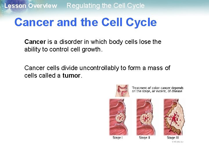 Lesson Overview Regulating the Cell Cycle Cancer and the Cell Cycle Cancer is a