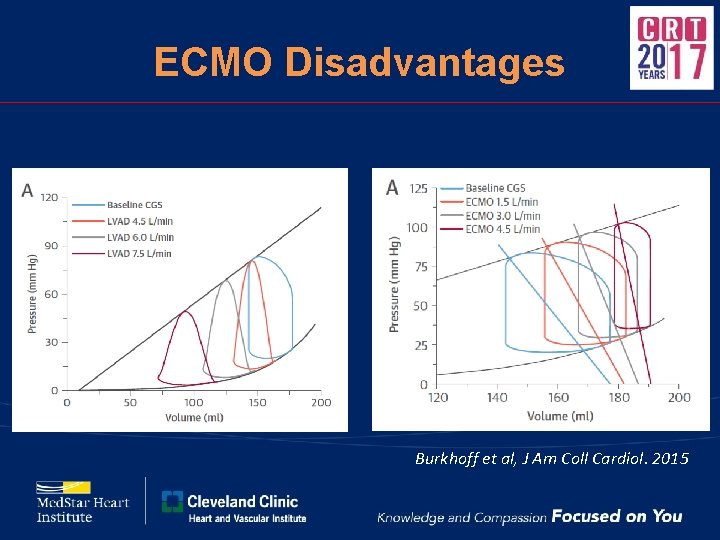 ECMO Disadvantages Burkhoff et al, J Am Coll Cardiol. 2015 