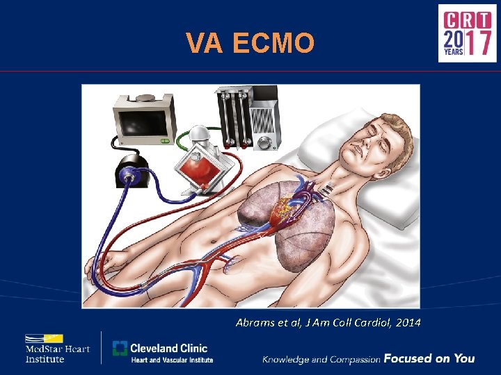 VA ECMO Abrams et al, J Am Coll Cardiol, 2014 