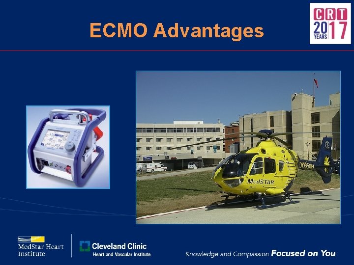 ECMO Advantages 