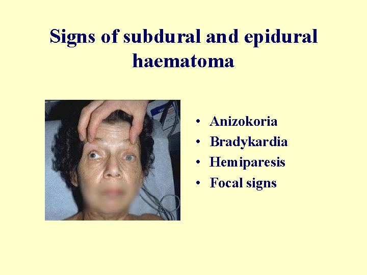 Signs of subdural and epidural haematoma • • Anizokoria Bradykardia Hemiparesis Focal signs 