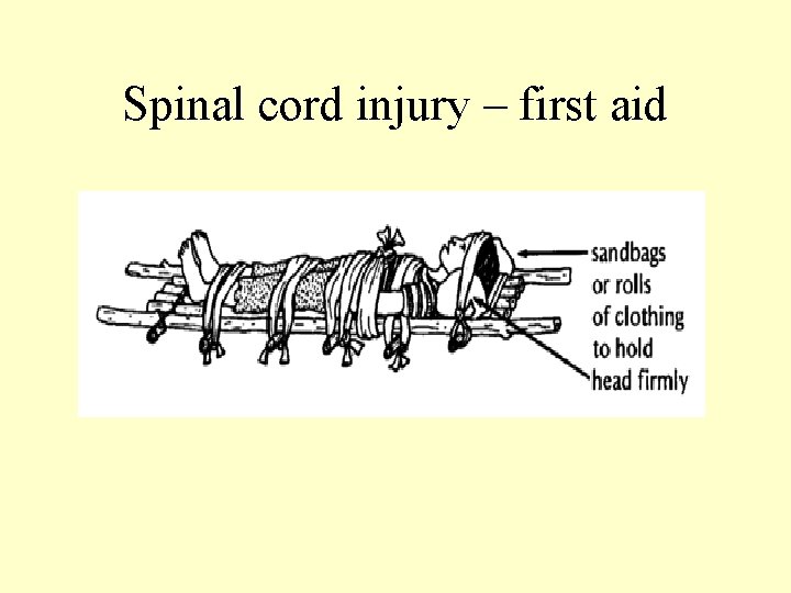 Spinal cord injury – first aid 